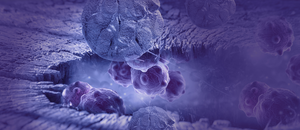 breast-cancer-cells