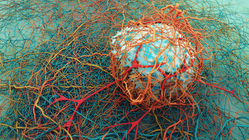 cancer-cell